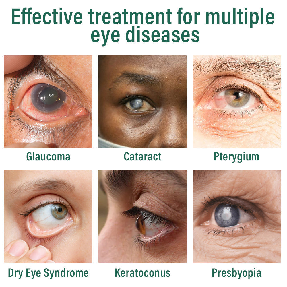 Nano Eye Drops Serum ✅FDA Approved(Suitable for presbyopia, dry eye syndrome, glaucoma, and cataracts) 👀