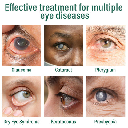 Nano Eye Drops Serum ✅FDA Approved(Suitable for presbyopia, dry eye syndrome, glaucoma, and cataracts) 👀