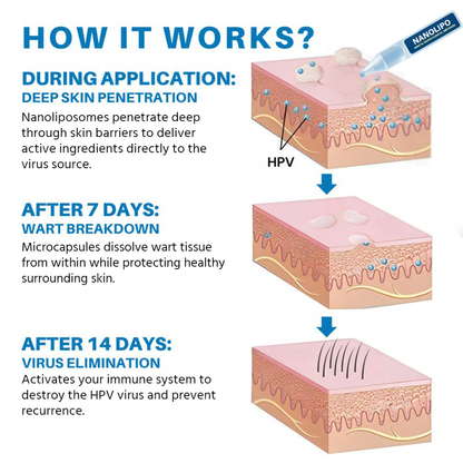 NanoLipo Genital Warts Clinical Ampoules