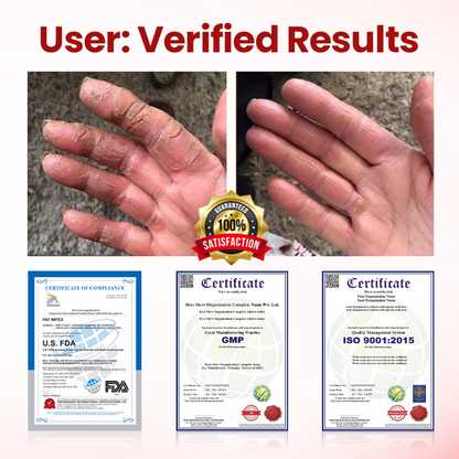 VitaGluco Diabetic Care Cream